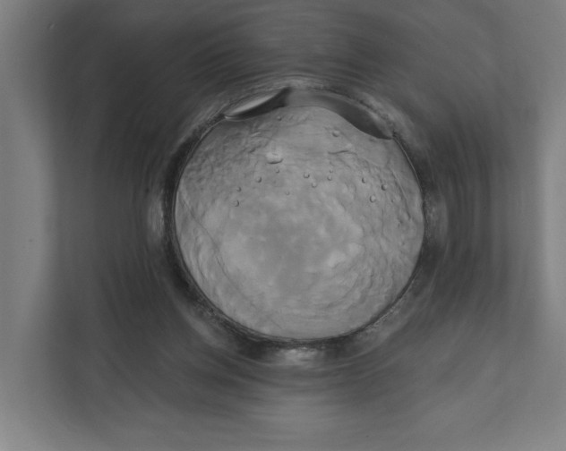 X0000111820158200908201138