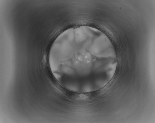 X0000111820166200908201138
