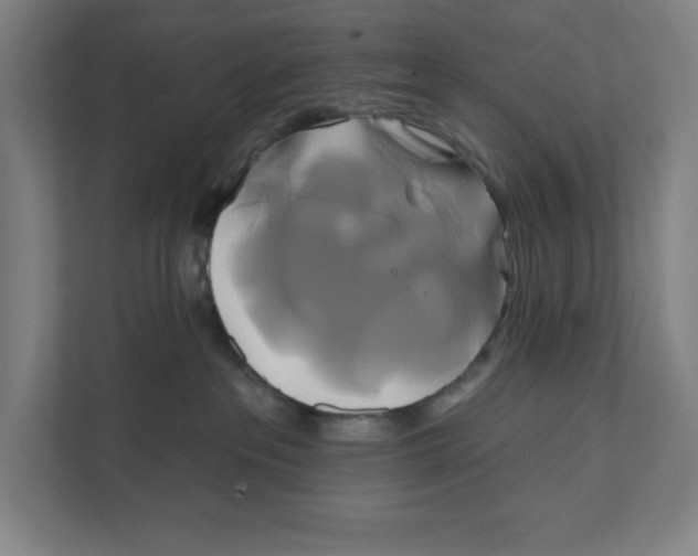 X0000111820237200908201137