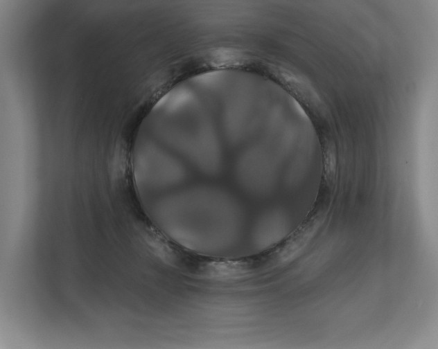 X0000111820367200908201135