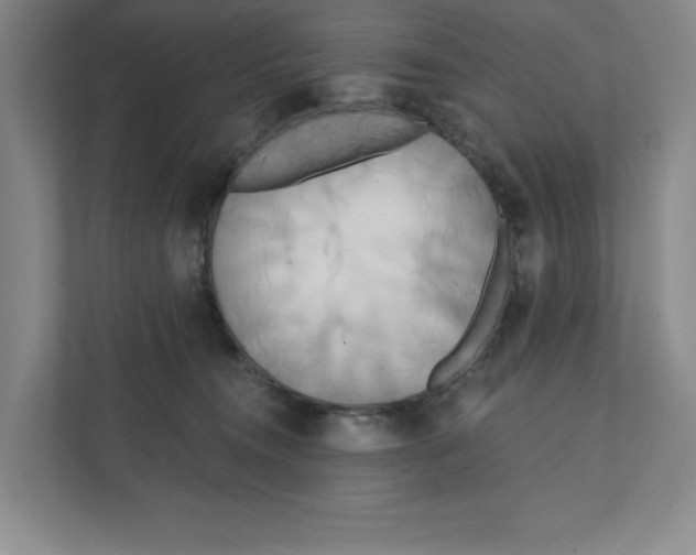 X0000111820372200908201135
