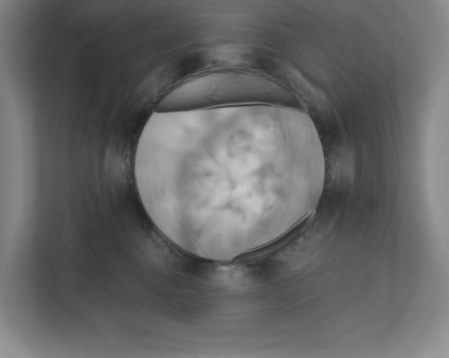 X0000111820376200908201135