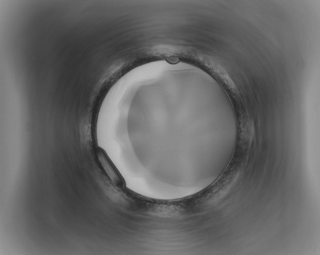 X0000111820399200908201135