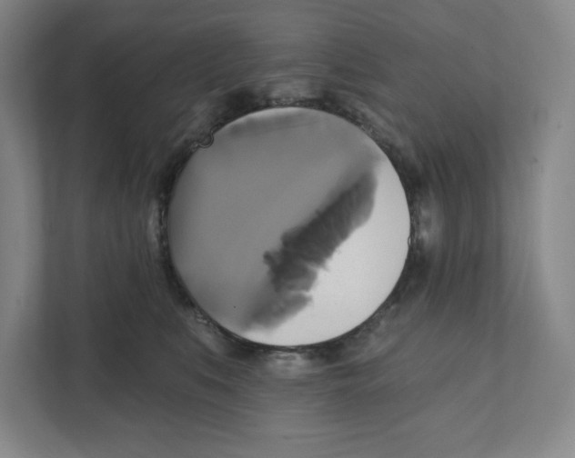 X0000111820519200908201133