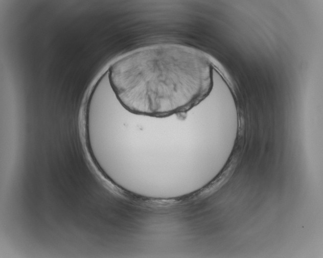 X0000111820859200908201129