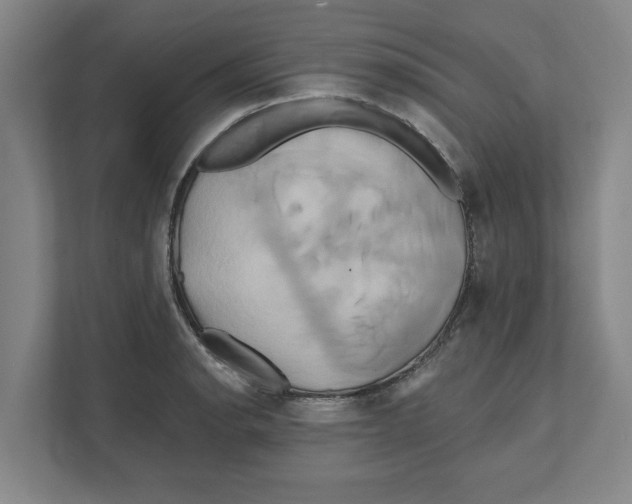 X0000111821134200908201125