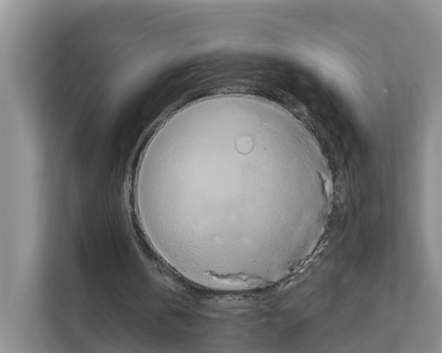 X0000111820146200909031457