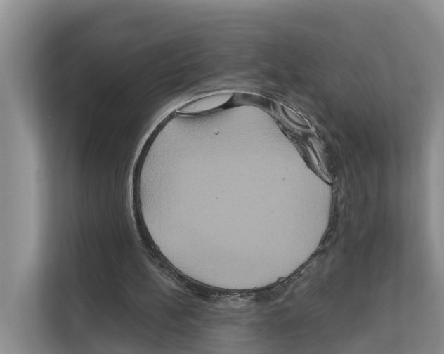 X0000111820148200909031457