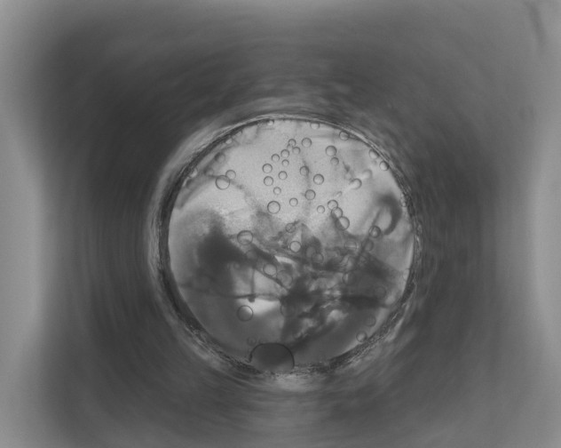 X0000111820149200909031457