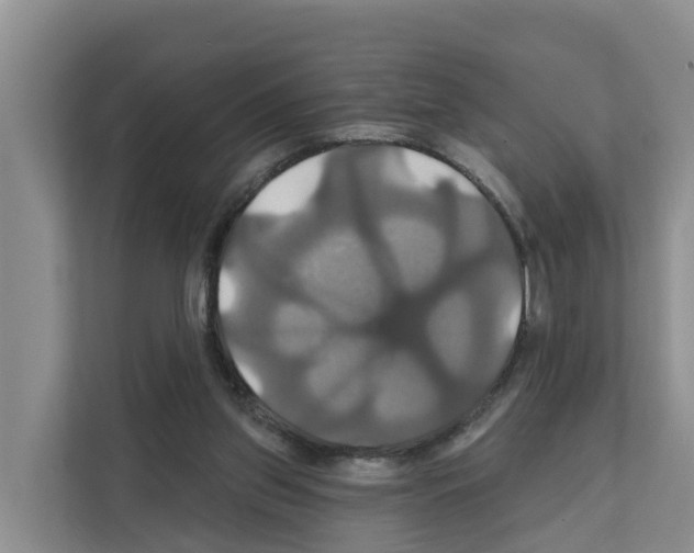 X0000111820157200909031457