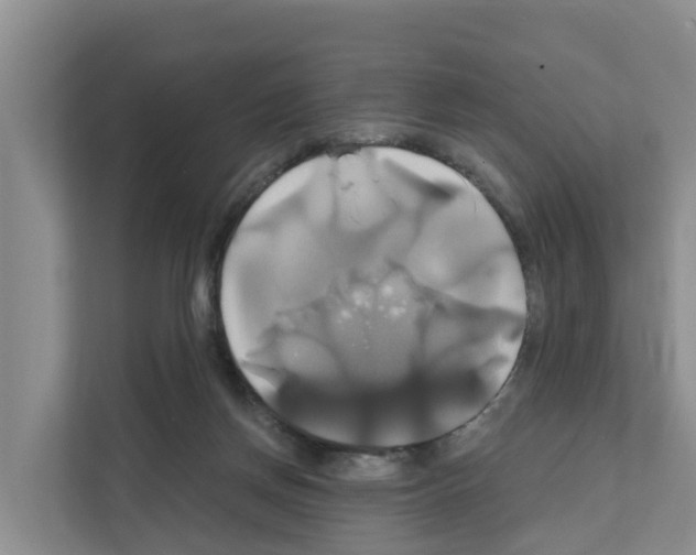 X0000111820166200909031457