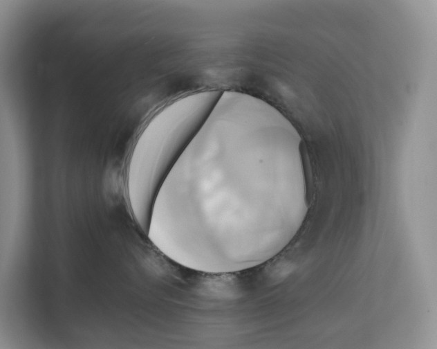 X0000111820576200909031453