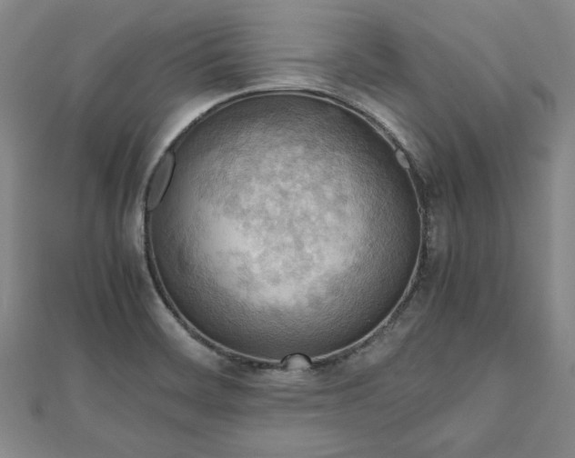 X0000111841468200907301039