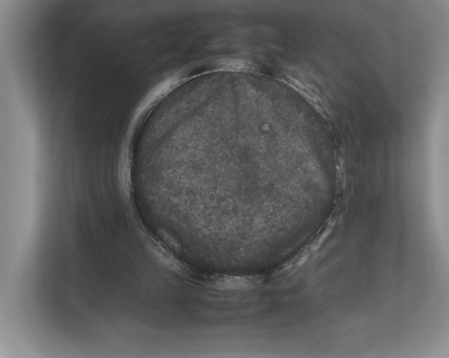 X0000111840149200908131426