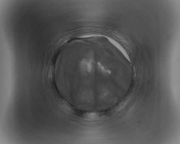 X0000111840325200908201222