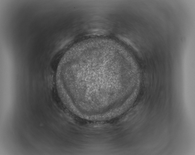 X0000111851399200908201228