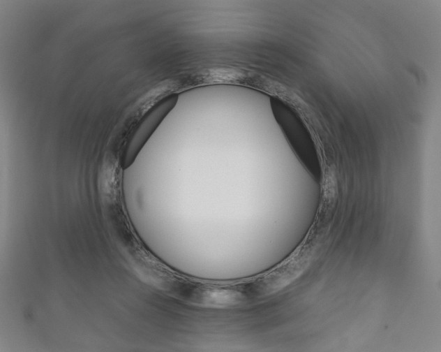 X0000111860360200907231135