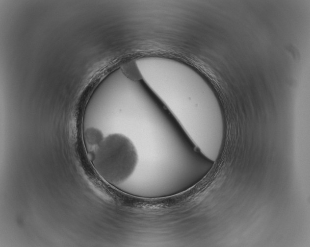 X0000111860638200907231131