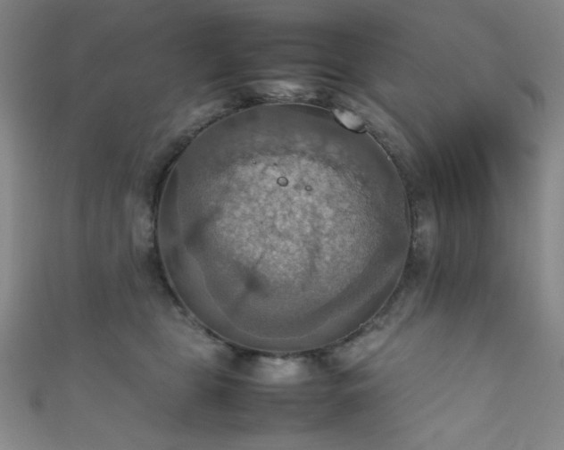 X0000111860469200907231455