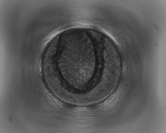 X0000111861455200907231442