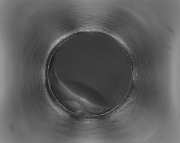 X0000111860438200908061339