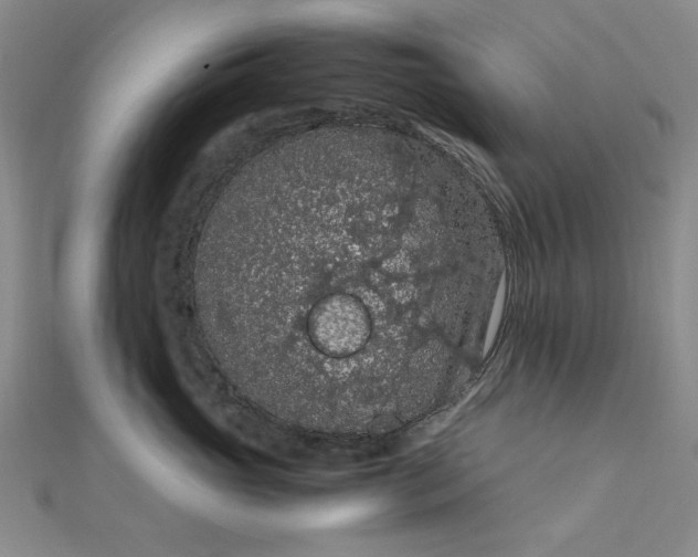 X0000111860765200908061335