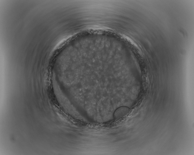 X0000111860775200908061335