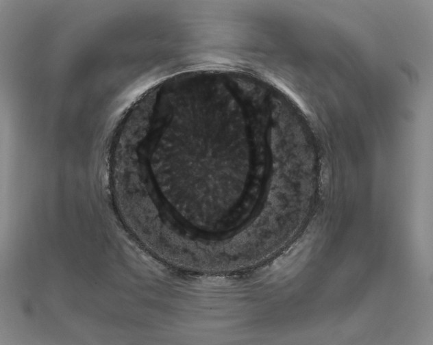 X0000111861455200908061325