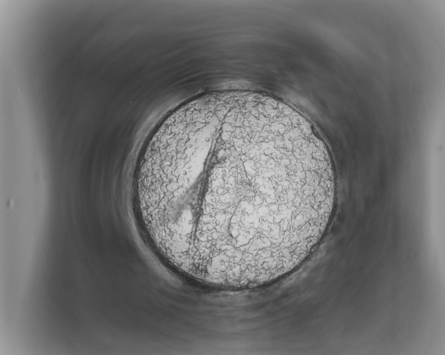 X0000111860049200908131507