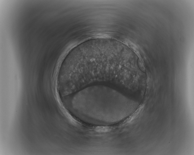 X0000111860145200908131506