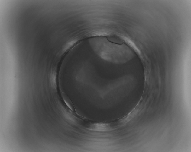 X0000111860154200908131506