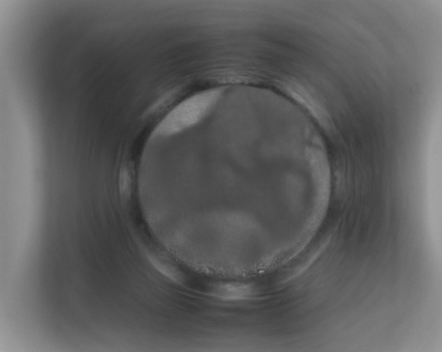 X0000111860165200908131506