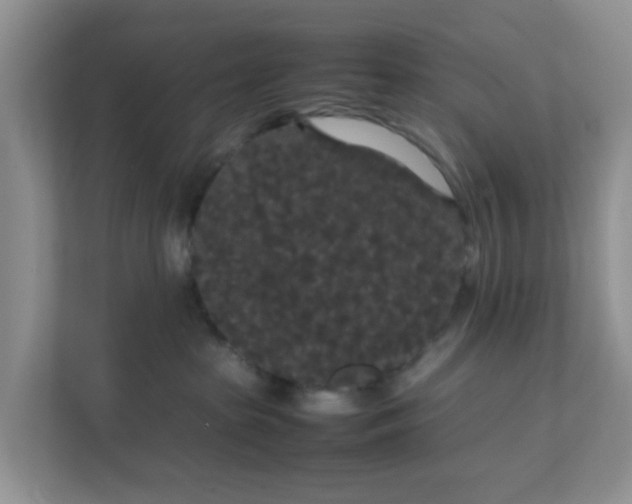 X0000111860285200908131505