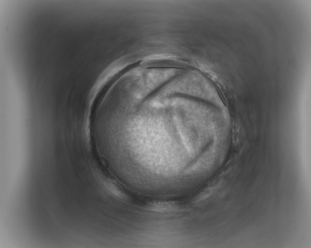 X0000111860296200908131505