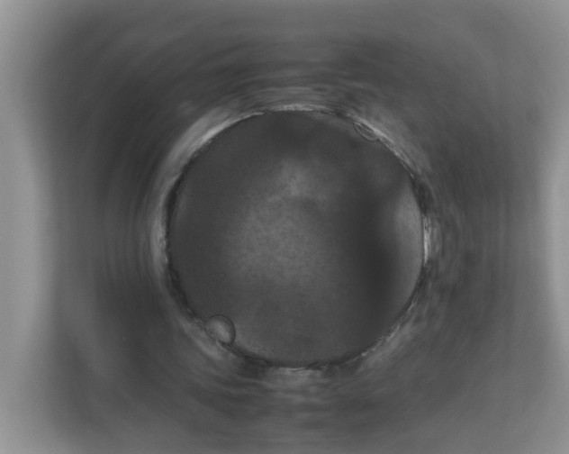 X0000111860339200908131503