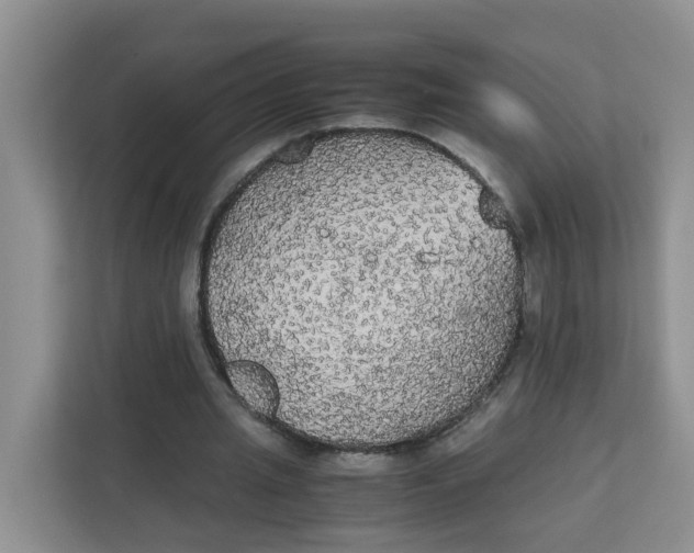 X0000111860437200908131502