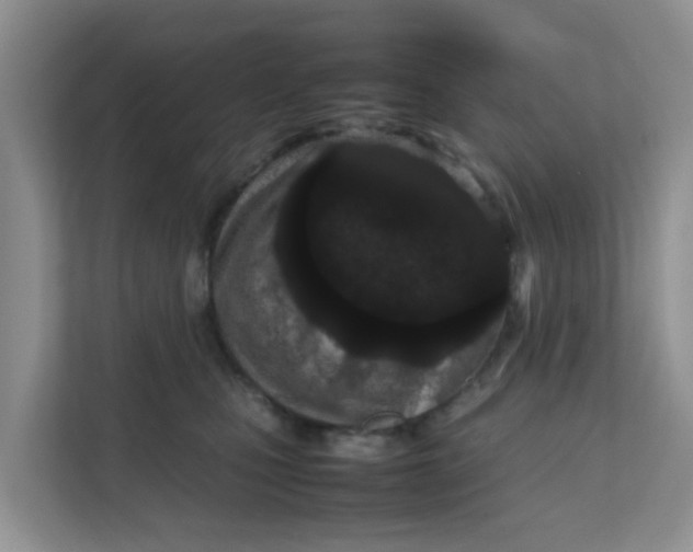 X0000111860471200908131503