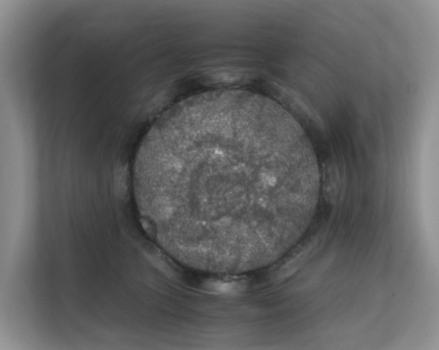 X0000111860563200908131501