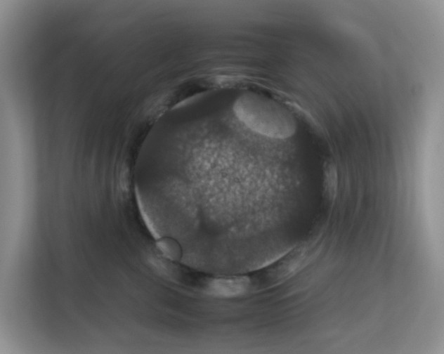 X0000111860571200908131501