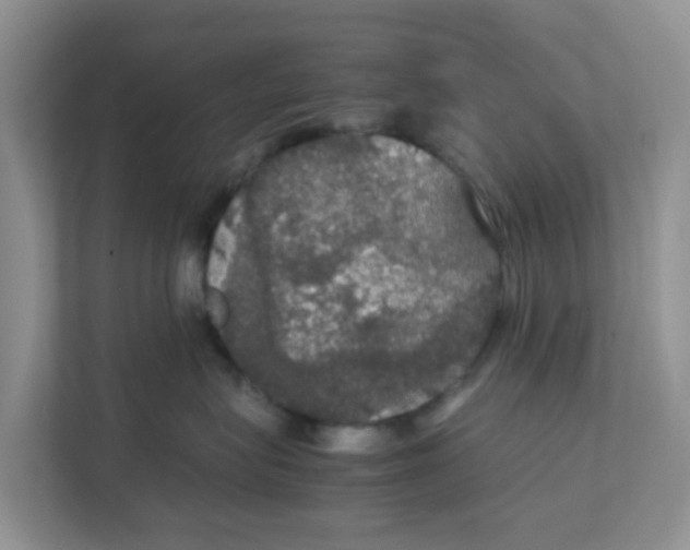 X0000111860575200908131501