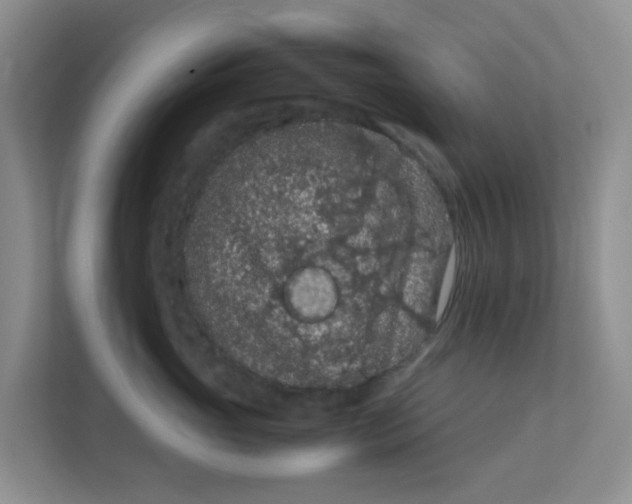 X0000111860765200908131459