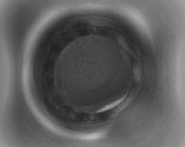 X0000111860766200908131459