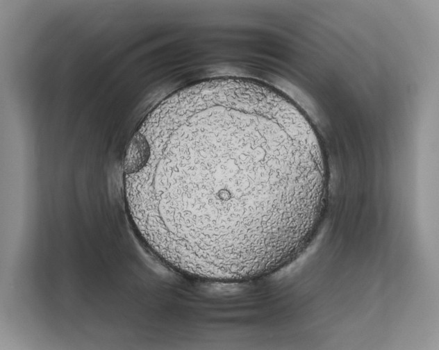 X0000111860849200908131458