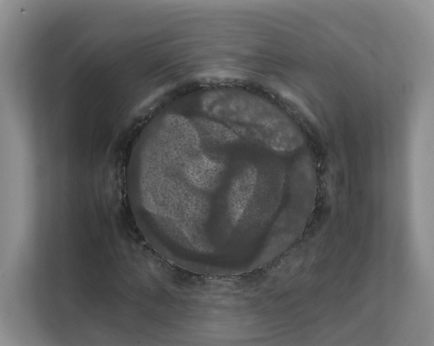 X0000111860870200908131457