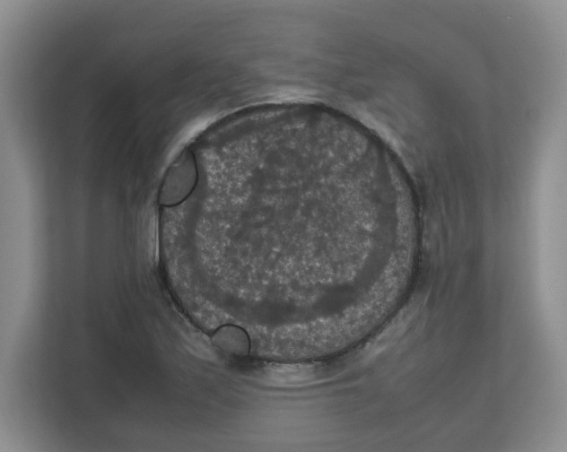 X0000111861171200908131453