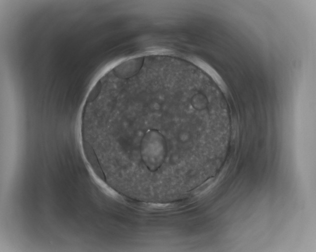 X0000111861439200908131450