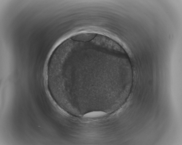 X0000111861522200908131449