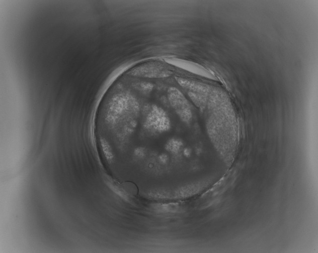 X0000111860147200908201304
