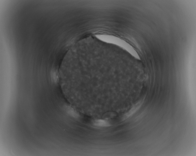 X0000111860285200908201304