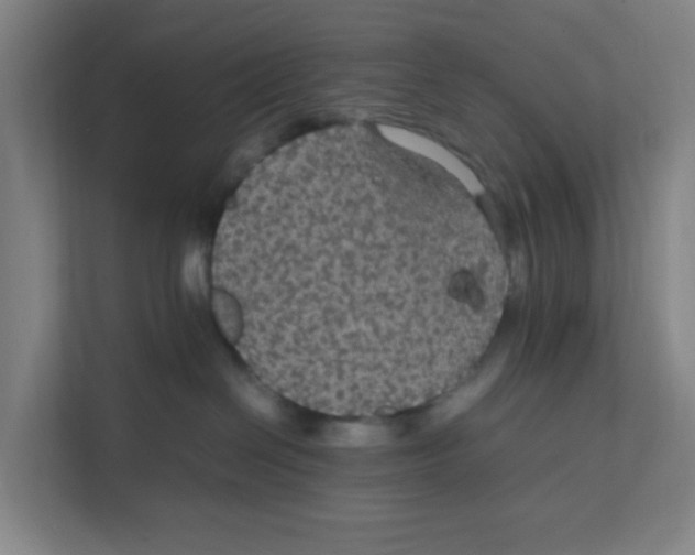 X0000111860286200908201304